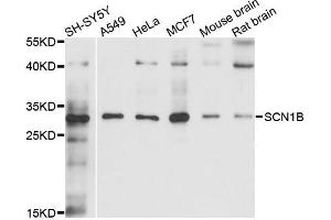 Western blot analysis of extracts of various cells, using SCN1B antibody. (SCN1B anticorps)