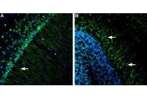 Expression of Presenilin-1 in mouse brain - Immunohistochemical staining of mouse hippocampus and mouse cerebellum using Anti-Presenilin-1 Antibody (ABIN7043552, ABIN7044524 and ABIN7044525), (1:600).