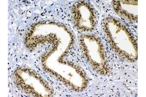 IHC analysis of XRCC1 using anti-XRCC1 antibody .