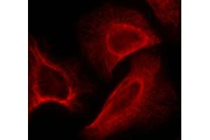 Immunofluorescence staining of methanol-fixed Hela cells showing cytoplasmic, centrosomal and nuclear staining using p70 S6 Kinase(Phospho-Ser424) Antibody.