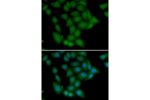 Immunofluorescence analysis of U20S cell using CAMK1 antibody. (CAMK1 anticorps)