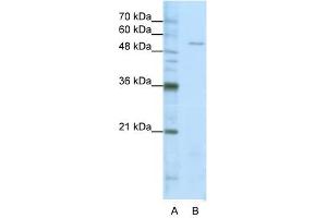SARS antibody used at 1. (Seryl-tRNA Synthetase (SARS) (Middle Region) anticorps)