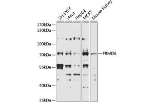 Western blot analysis of extracts of various cell lines, using FRMD6 antibody (ABIN6132194, ABIN6140773, ABIN6140774 and ABIN6225347) at 1:1000 dilution. (FRMD6 anticorps  (AA 405-614))