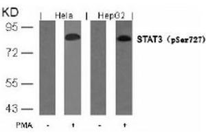 Image no. 3 for anti-Signal Transducer and Activator of Transcription 3 (Acute-Phase Response Factor) (STAT3) (pSer727) antibody (ABIN196692) (STAT3 anticorps  (pSer727))