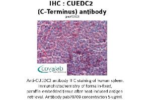 Image no. 2 for anti-CUE Domain Containing 2 (CUEDC2) (C-Term) antibody (ABIN1733372) (CUEDC2 anticorps  (C-Term))