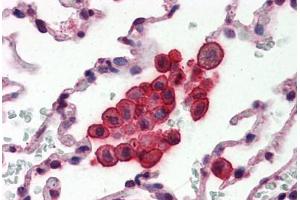 Human Lung (formalin-fixed, paraffin-embedded) stained with CLU antibody ABIN364331 at 10 ug/ml followed by biotinylated anti-mouse IgG secondary antibody ABIN481714, alkaline phosphatase-streptavidin and chromogen. (Clusterin anticorps  (AA 1-333))