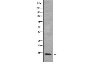 Western blot analysis of Cytochrome P450 3A43 expression in HEK293 cells ,The lane on the left is treated with the antigen-specific peptide.