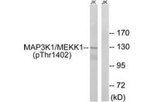 Western blot analysis of extracts from Jurkat cells, using MAP3K1 (Phospho-Thr1402) Antibody. (MAP3K1 anticorps  (pThr1402))