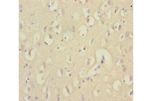 Immunohistochemistry of paraffin-embedded human brain tissue using ABIN7151538 at dilution of 1:100