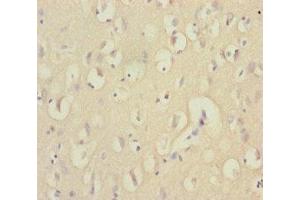Immunohistochemistry of paraffin-embedded human brain tissue using ABIN7151538 at dilution of 1:100 (EEF1A2 anticorps  (AA 184-463))