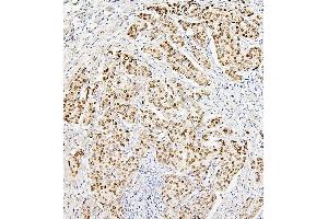 IHC analysis of H1F0 using anti-H1F0 antibody (ABIN7600521). (Histone H1 anticorps  (AA 20-159))