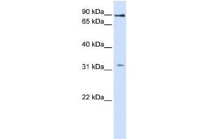 WB Suggested Anti-LRRC8B Antibody Titration:  1 ug/ml  Positive Control:  Fetal liver cell lysate (LRRC8B anticorps  (Middle Region))