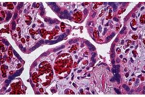 Human Placenta, Trophoblast: Formalin-Fixed, Paraffin-Embedded (FFPE) (ERBB3 anticorps  (AA 21-332))