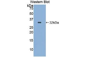 Western blot analysis of the recombinant protein. (ITFG1 anticorps  (AA 55-306))