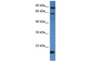 Western Blotting (WB) image for anti-Interleukin 4 Receptor (IL4R) (C-Term) antibody (ABIN2490400) (IL4 Receptor anticorps  (C-Term))