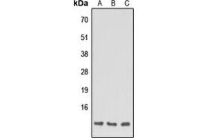 Western blot analysis of Apolipoprotein C1 expression in HEK293T (A), NS-1 (B), H9C2 (C) whole cell lysates. (APOC1 anticorps  (Center))