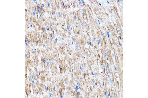 Immunohistochemistry of paraffin-embedded Mouse heart using L Rabbit pAb (ABIN7268192) at dilution of 1:100 (40x lens). (LATS2 anticorps  (AA 1-100))