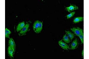 Immunofluorescent analysis of HepG2 cells using ABIN7145708 at dilution of 1:100 and Alexa Fluor 488-congugated AffiniPure Goat Anti-Rabbit IgG(H+L)