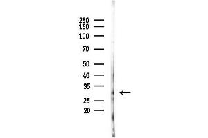 anti-Glucosamine-6-Phosphate Deaminase 2 (GNPDA2) (N-Term) antibody