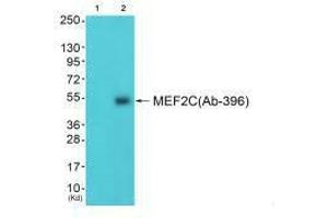 Western blot analysis of extracts from 3T3 cells (Lane 2), using MEF2C (Ab-396) antiobdy. (MEF2C anticorps  (Ser396))
