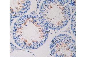 IHC-P analysis of Kidney tissue, with DAB staining. (NEXN anticorps  (AA 421-607))