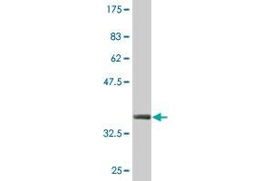 Western Blot detection against Immunogen (36. (ZSCAN16 anticorps  (AA 132-230))