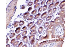 IHC analysis of Flt3 / CD135 using anti-Flt3 / CD135 antibody .
