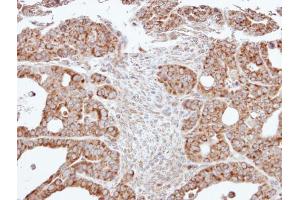 IHC-P Image Immunohistochemical analysis of paraffin-embedded NCI-N87 xenograft, using ACADM, antibody at 1:500 dilution. (Medium-Chain Specific Acyl-CoA Dehydrogenase, Mitochondrial (MCAD) (Center) anticorps)