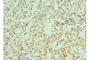 Immunohistochemistry of paraffin-embedded human spleen tissue using ABIN7156941 at dilution of 1:100 (IL-9 anticorps  (AA 19-144))