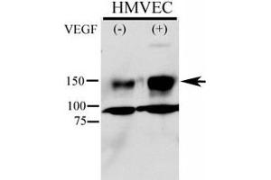 Phospho-KDR antibody used in western blot to detect phosphorylated KDR/FLK1 in HMVEC lysate. (VEGFR2/CD309 anticorps  (pTyr996))