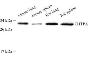 Western blot analysis of THTPA (ABIN7075879),at dilution of 1: 800 (THTPA anticorps)