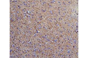 IHC analysis of Hexokinase 1/HK1 using anti-Hexokinase 1/HK1 antibody (ABIN7600260). (Hexokinase 1 anticorps  (AA 17-323))