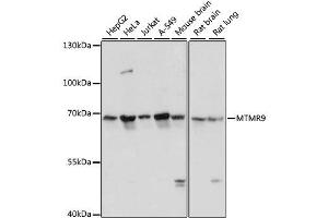 Western blot analysis of extracts of various cell lines, using MTMR9 antibody. (MTMR9 anticorps  (AA 1-250))