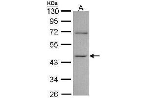 WB Image Sample (30 ug of whole cell lysate) A: A431 , 10% SDS PAGE antibody diluted at 1:1000 (ITPK1 anticorps)