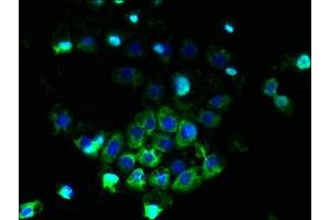 Immunofluorescent analysis of A431 cells using ABIN7144889 at dilution of 1:100 and Alexa Fluor 488-congugated AffiniPure Goat Anti-Rabbit IgG(H+L) (ABCB5 anticorps  (AA 547-760))