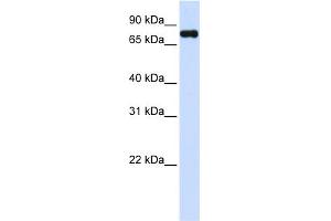 WB Suggested Anti-ZFYVE1 Antibody Titration:  0. (ZFYVE1 anticorps  (C-Term))