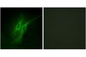 Immunofluorescence analysis of HeLa cells, using 5-HT-4 Antibody. (Serotonin Receptor 4 anticorps  (AA 21-70))