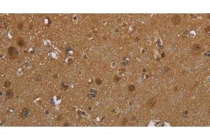 Immunohistochemistry of paraffin-embedded Human brain tissue using SCGB1D2 Polyclonal Antibody at dilution 1:40 (SCGB1D2 anticorps)