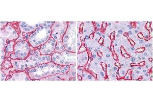 Anti collagen IV antibody (1:400, 45 min RT) showed strong staining in FFPE sections of human kidney (Left) with strong red staining observed in glomeruli and liver (Right) with strong staining in sinusoids. (Collagen IV anticorps)