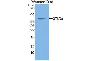 Detection of Recombinant MYH6, Rat using Polyclonal Antibody to Myosin Heavy Chain 6, Cardiac Muscle, Alpha (MYH6)