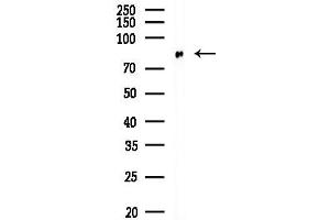 Western blot analysis of lysates from HUVEC cells, using ARHGEF19 Antibody at 1/1000 dilution.