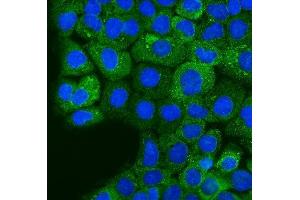 anti-Ezrin (EZR) (N-Term) antibody