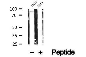 Western blot analysis of extracts of HeLa cells, using SEC6 antibody. (EXOC3 anticorps  (Internal Region))