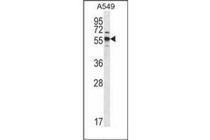 Western blot analysis of SPNS3 Antibody (C-term) in A549 cell line lysates (35ug/lane). (SPNS3 anticorps  (C-Term))