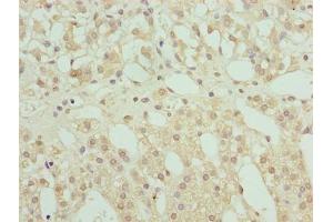 Immunohistochemistry of paraffin-embedded human adrenal gland tissue using ABIN7168234 at dilution of 1:100 (RING1 anticorps  (AA 401-630))