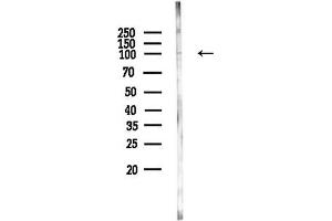 anti-Ankyrin Repeat Domain 20 Family, Member A1 (ANKRD20A1) antibody