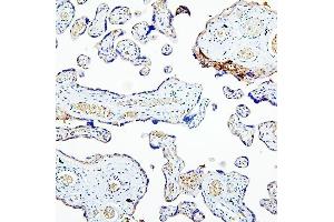 IHC analysis of MUC20 using anti-MUC20 antibody (ABIN6719588).