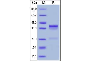 Mouse CTGF, His Tag on  under reducing (R) condition. (CTGF Protein (AA 26-348) (His tag))