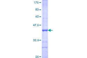 Image no. 1 for Bromodomain Adjacent To Zinc Finger Domain, 1A (BAZ1A) (AA 1457-1556) protein (GST tag) (ABIN1346450)