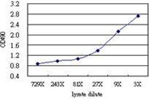 KLHDC4 (Human) Matched Antibody Pair